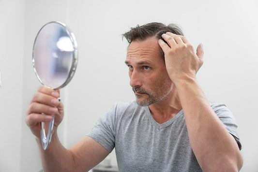 Early receding hairline? Here's how to increase hair growth!