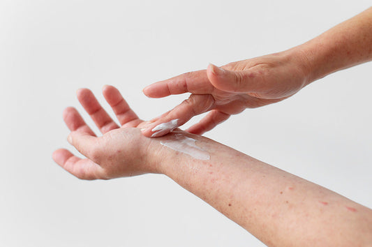 Eczema: Causes, Symptoms and Treatment with Supplements